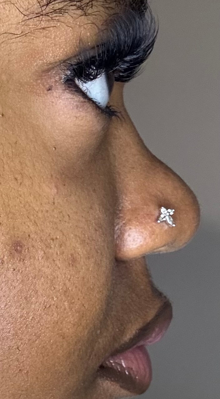 " Angel"